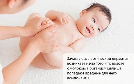 โรคผิวหนังอักเสบภูมิแพ้ในเด็ก