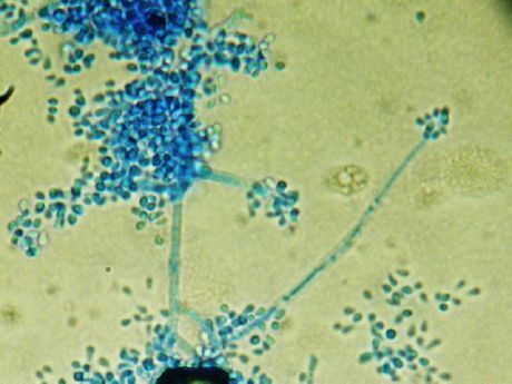 สาเหตุที่ทำให้เกิด favus (Trichophyton schoenleinii)
